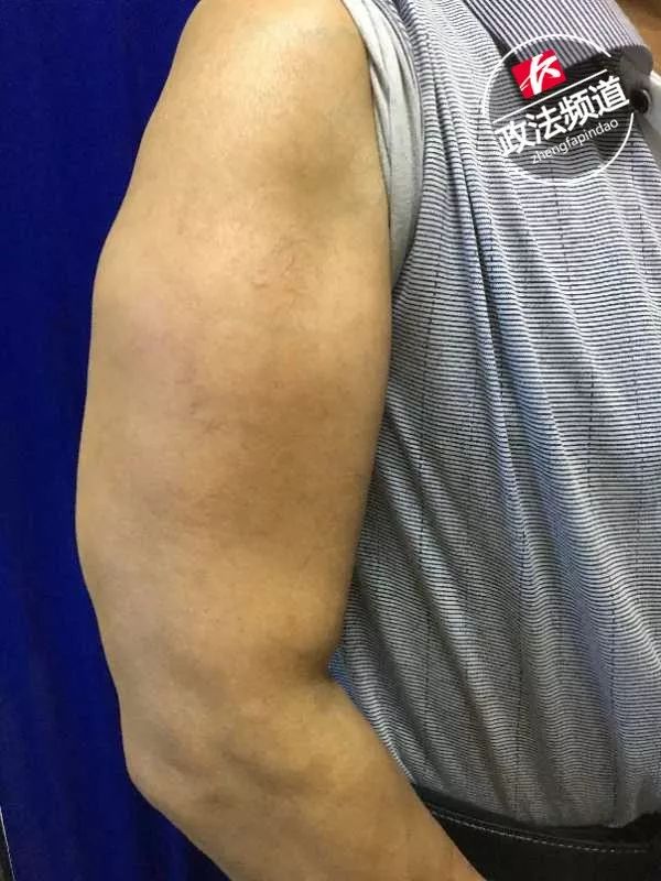 医院门诊来了两位“绿巨人”,他们都爱喝这个…