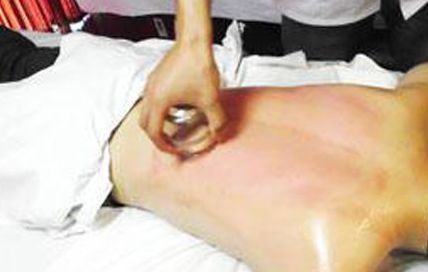 八卦手针疗法治疗感冒,中医走罐治疗的疾病