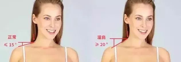 长期低头玩手机脖子会变粗,长期低头玩手机如何改善肩部