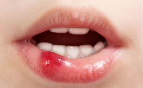 美国nasa咽喉喷剂,美国防止细菌的喷雾