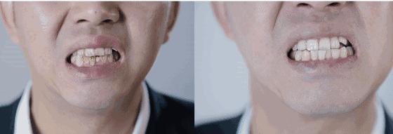 牙粉去烟渍牙结石牙膏排名第一名,美白牙膏推荐去牙黄老牌子