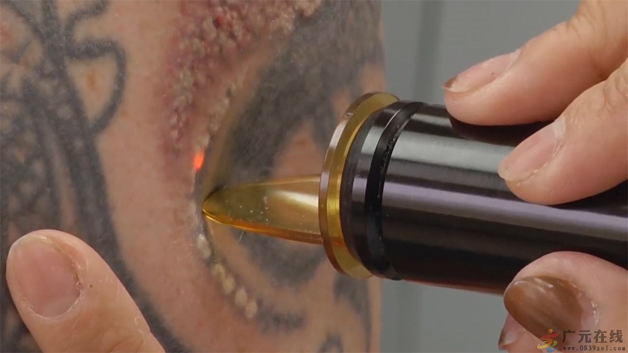 纹身不打麻药是几级痛,纹身疼不疼看图