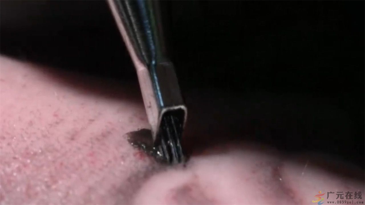 纹身不打麻药是几级痛,纹身疼不疼看图