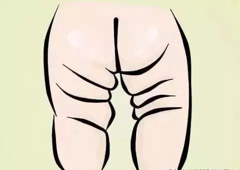 孩子臀纹不对称，看完门诊还是不明白？一次性解答你所有问题