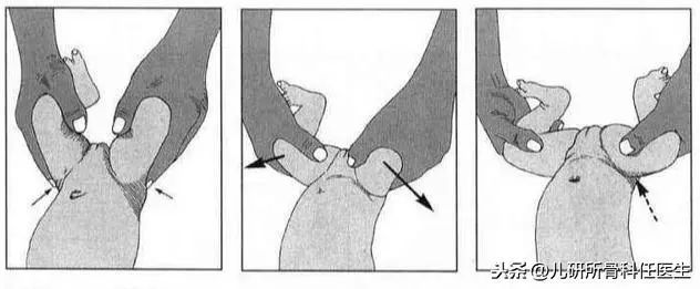 孩子臀纹不对称，看完门诊还是不明白？一次性解答你所有问题