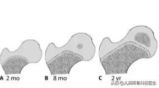 孩子臀纹不对称，看完门诊还是不明白？一次性解答你所有问题