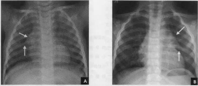 小学学霸学习方法大揭秘,小学学霸学习时间表