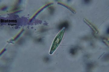 显微镜看到的藻类微生物形态图,藻类浮游生物