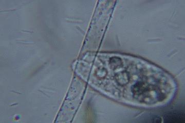 显微镜看到的藻类微生物形态图,藻类浮游生物