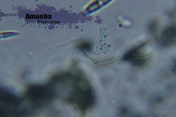 显微镜看到的藻类微生物形态图,藻类浮游生物