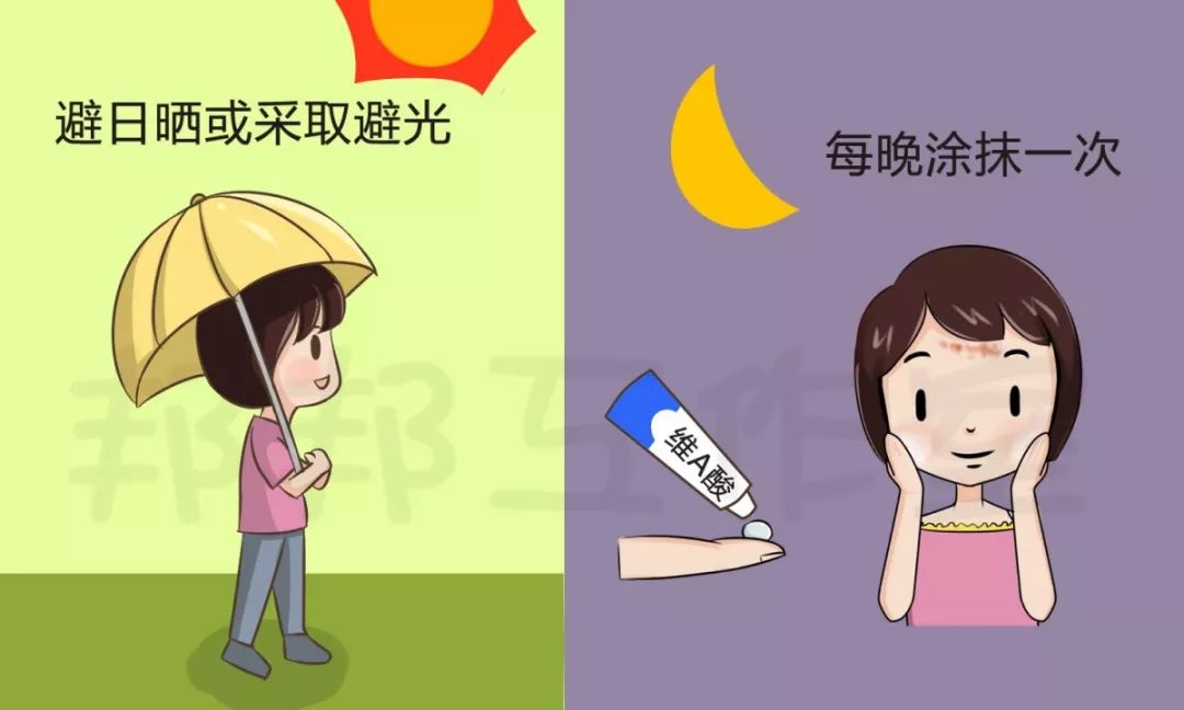 治痘印最有效的方法,有什么偏方祛痘印