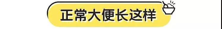 如何辨别宝宝大便颜色是否正常,宝宝所有大便的颜色及症状