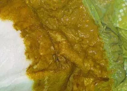 如何辨别宝宝大便颜色是否正常,宝宝所有大便的颜色及症状