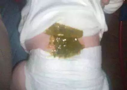 如何辨别宝宝大便颜色是否正常,宝宝所有大便的颜色及症状