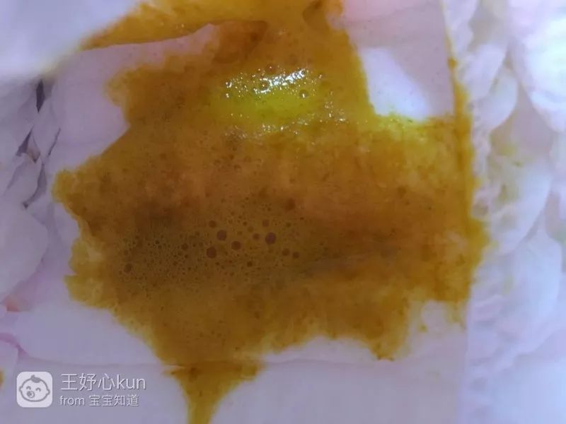 如何辨别宝宝大便颜色是否正常,宝宝所有大便的颜色及症状