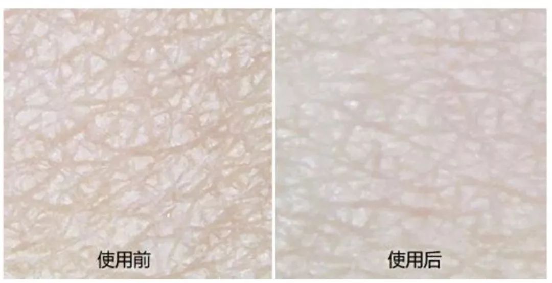 小个子女生要怎么穿衣服好看,小个子女生怎么穿1米7