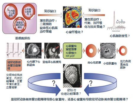 「2019CIHFC」高传玉教授：HFpEF诊断治疗新进展