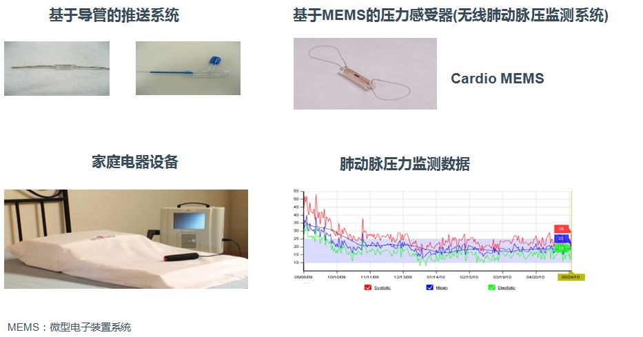 「2019CIHFC」高传玉教授：HFpEF诊断治疗新进展