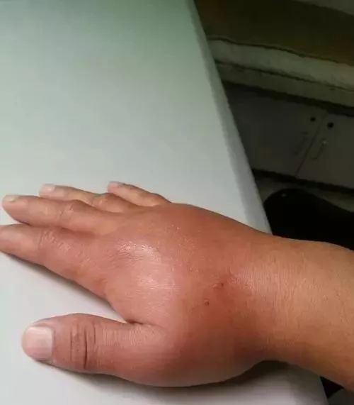 女子半夜惊醒发现有人站床边,女子半夜惊醒陌生男子站在眼前