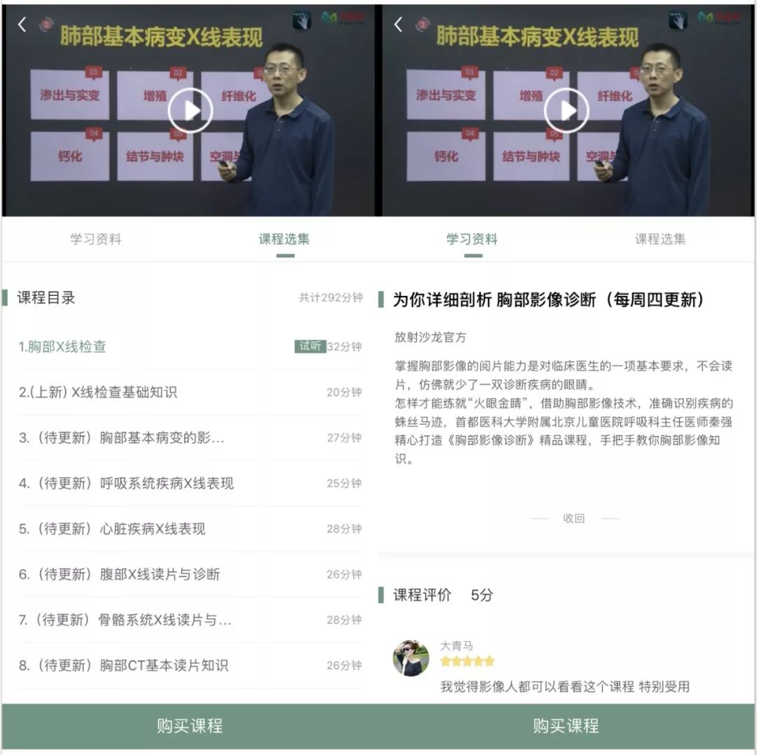 椎间盘膨出脱出图解,椎间盘膨出脱出和突出哪个更严重