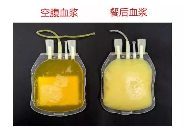 空腹抽血前能喝水吗？要停药吗？是时候告诉你啥叫空腹了