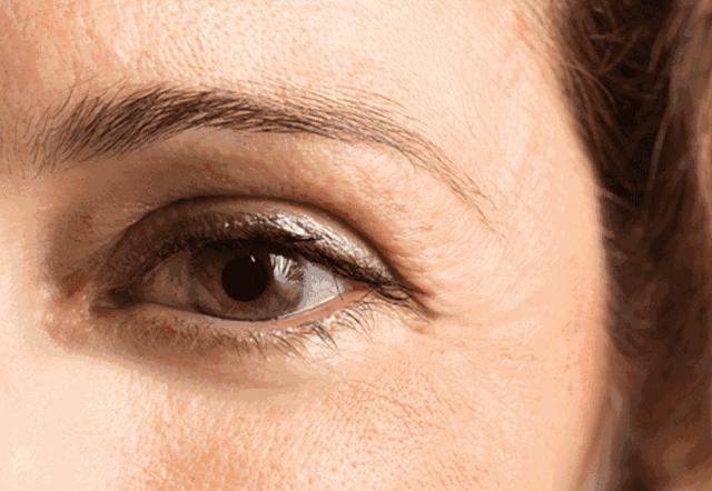 热玛吉抗衰老手术适应6类人群,了解热玛吉抗衰老看这篇就够了