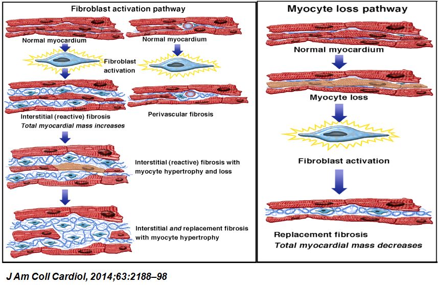 「2019CIHFC」张运教授：ADAM17—糖尿病性心肌病干预的新靶点