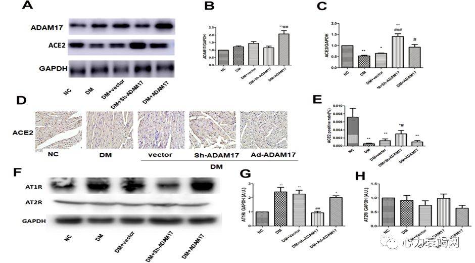 「2019CIHFC」张运教授：ADAM17—糖尿病性心肌病干预的新靶点
