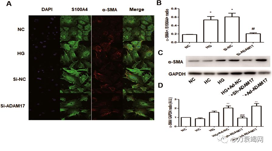 「2019CIHFC」张运教授：ADAM17—糖尿病性心肌病干预的新靶点