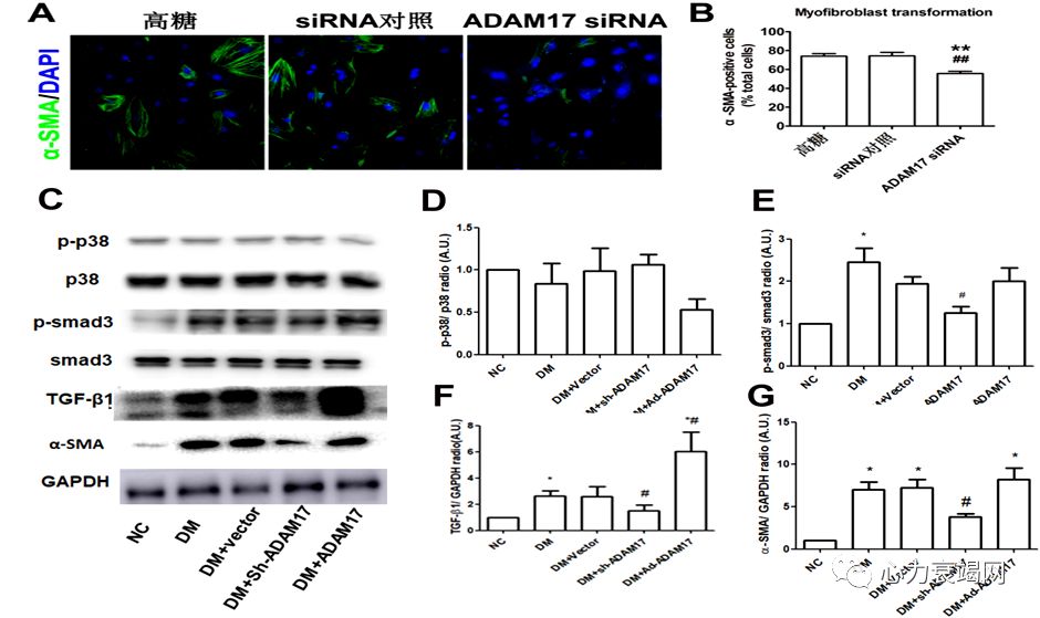 「2019CIHFC」张运教授：ADAM17—糖尿病性心肌病干预的新靶点