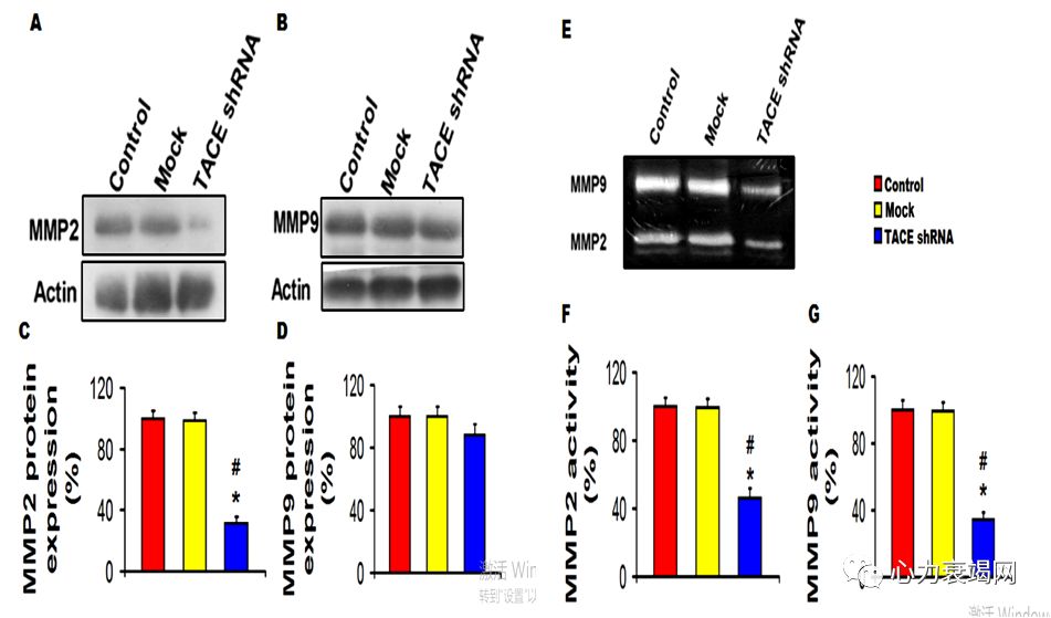 「2019CIHFC」张运教授：ADAM17—糖尿病性心肌病干预的新靶点