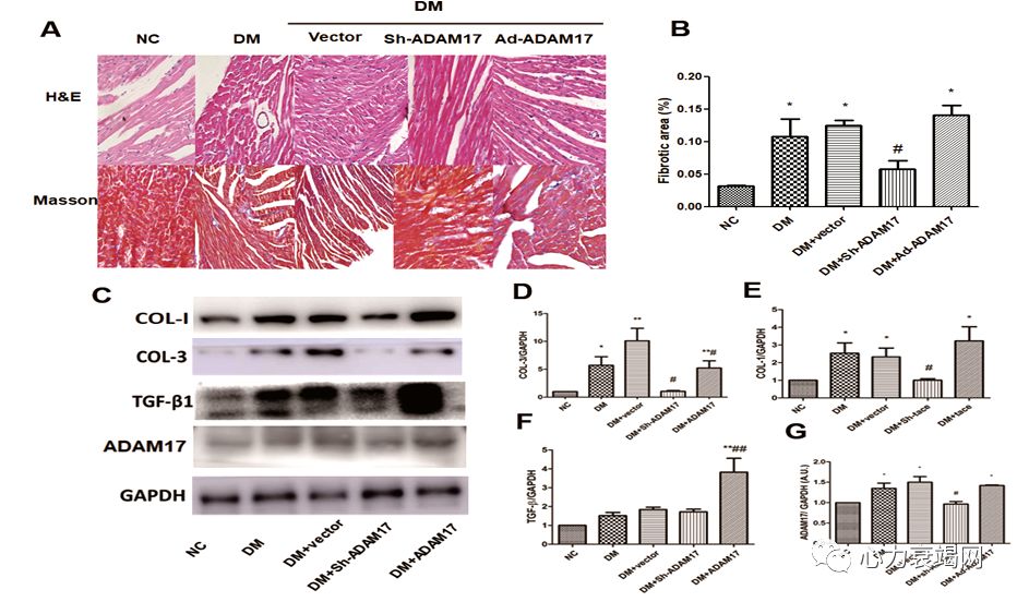 「2019CIHFC」张运教授：ADAM17—糖尿病性心肌病干预的新靶点