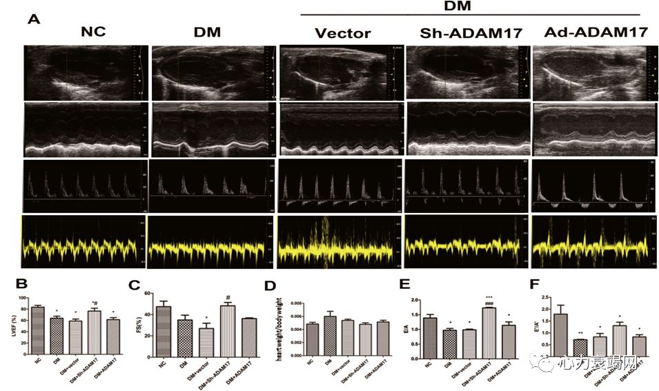 「2019CIHFC」张运教授：ADAM17—糖尿病性心肌病干预的新靶点