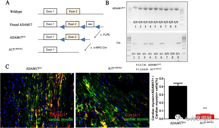 「2019CIHFC」张运教授：ADAM17—糖尿病性心肌病干预的新靶点