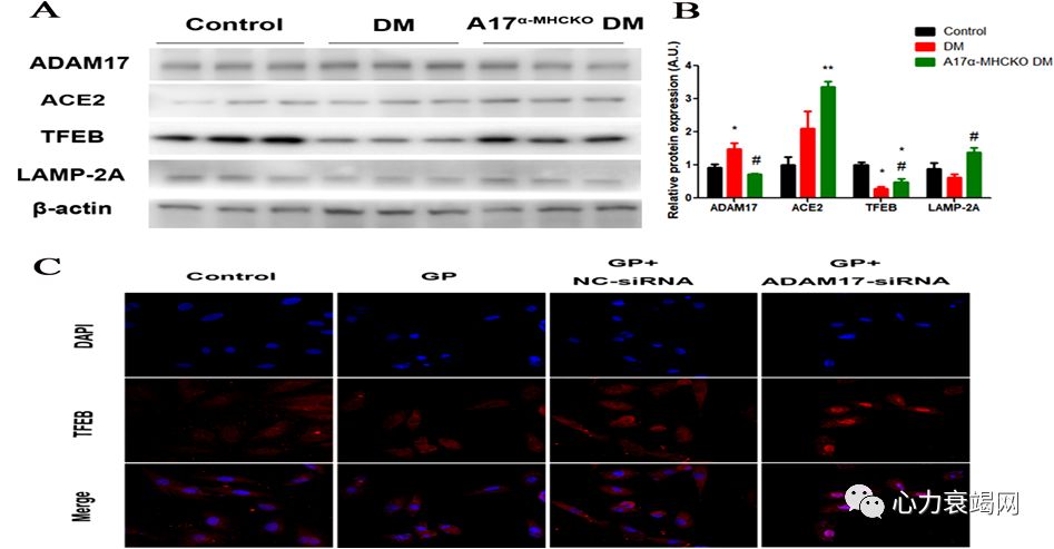 「2019CIHFC」张运教授：ADAM17—糖尿病性心肌病干预的新靶点