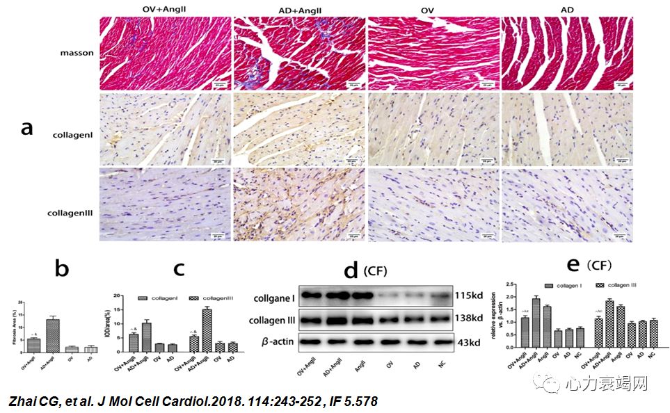 「2019CIHFC」张运教授：ADAM17—糖尿病性心肌病干预的新靶点