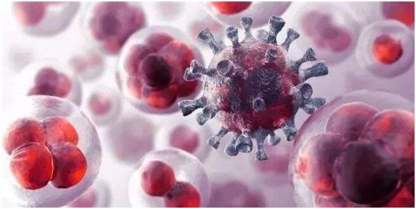 防癌筛查是阳性意味着什么,防癌筛查检测靠谱吗