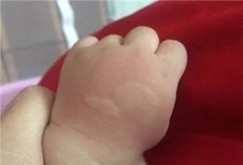 最有效的修复膏,市面好用的修复膏