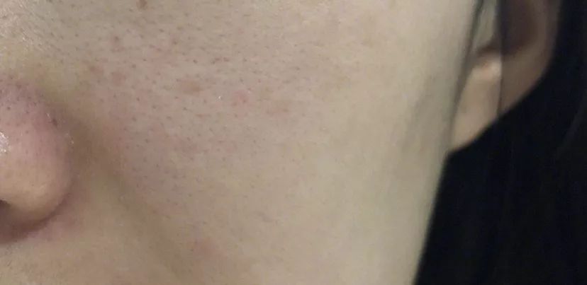 这个美白神器,3分钟让你素颜也能白成牛奶肌