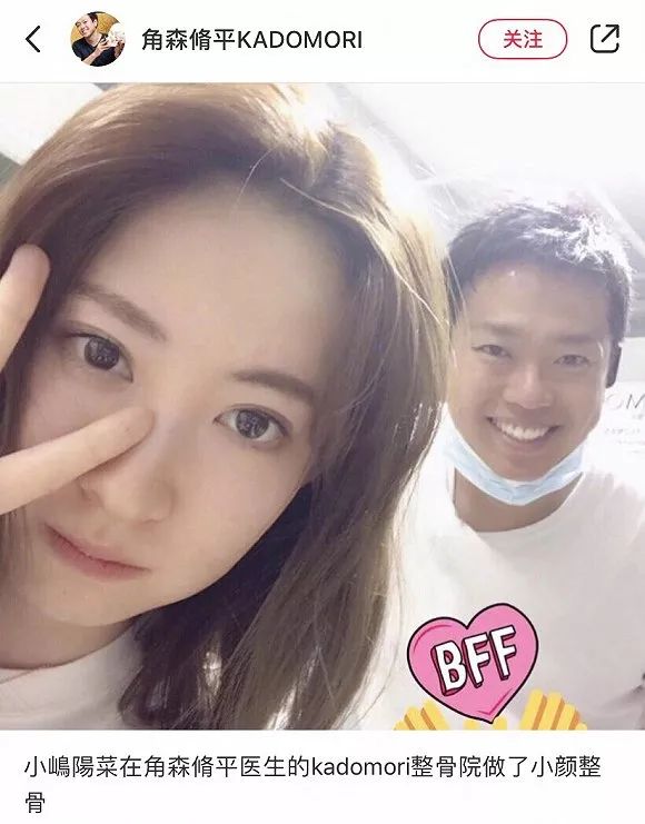 不动刀的整容,不动刀脸部轮廓紧致