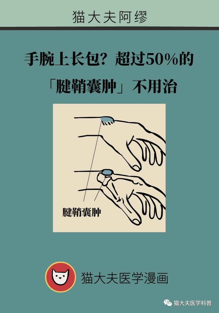 手腕长腱鞘囊肿,小孩手腕起了一个腱鞘囊肿要紧吗