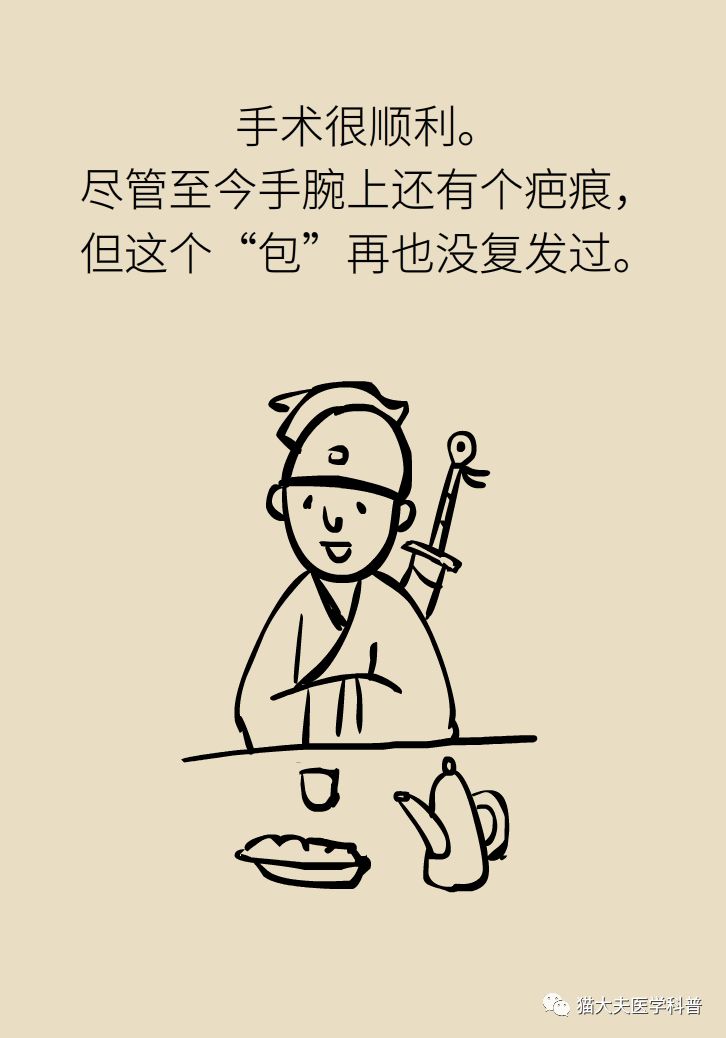 手腕长腱鞘囊肿,小孩手腕起了一个腱鞘囊肿要紧吗