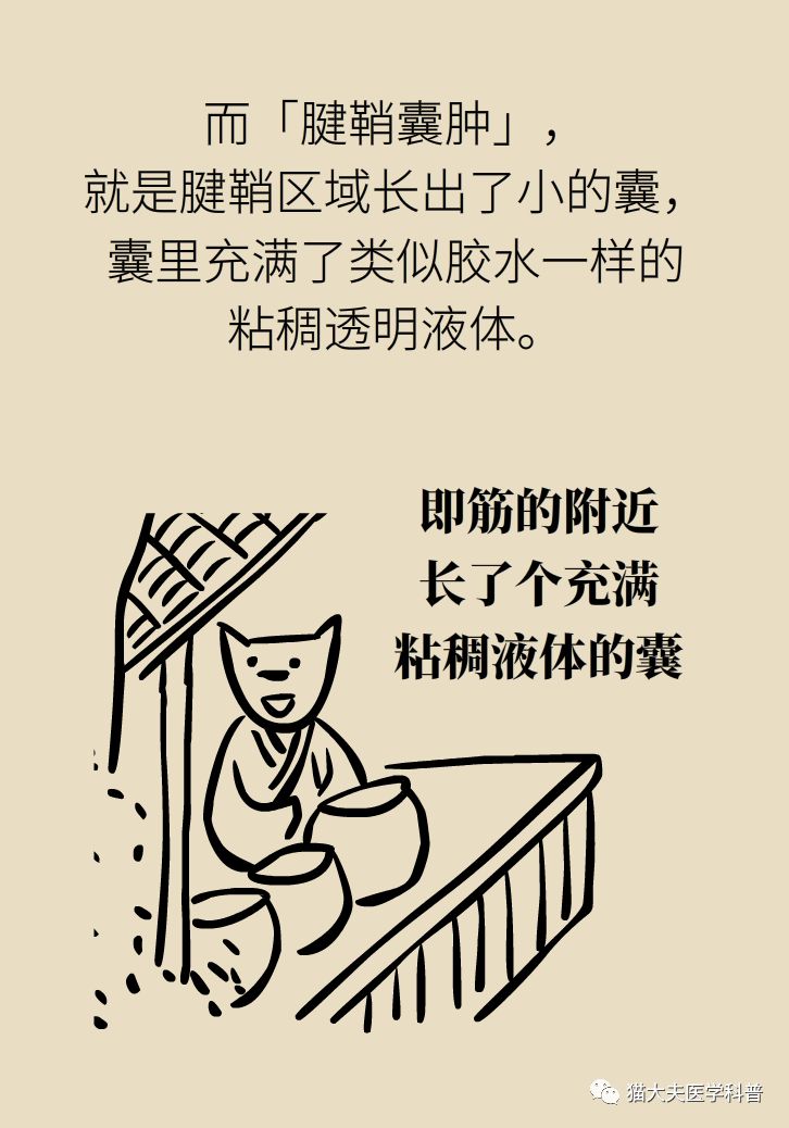 手腕长腱鞘囊肿,小孩手腕起了一个腱鞘囊肿要紧吗