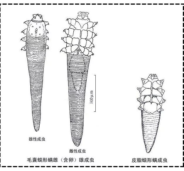 周冬雨17岁是什么样子,周冬雨17岁年轻时