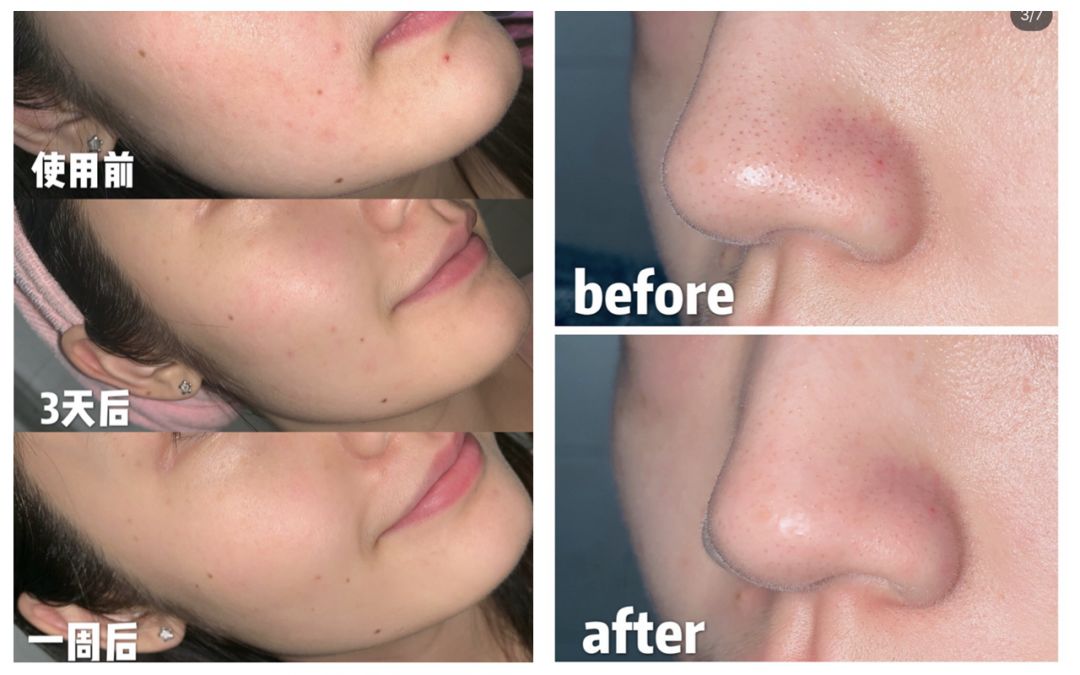 周冬雨17岁是什么样子,周冬雨17岁年轻时