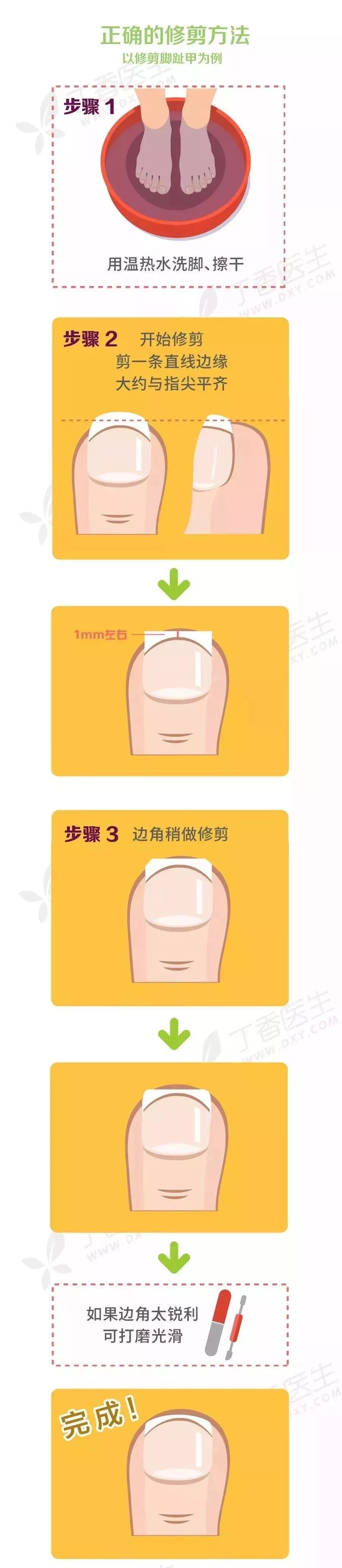 剪指甲错层,指甲该怎么剪才是正确的