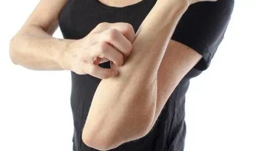 黄疸的四大症状,五种黄疸病