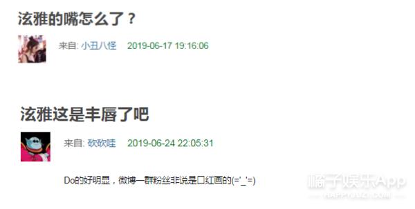 她说自己没整嘴巴……但是大家怎么都不信呢?