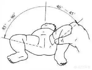 宝宝腿纹不对称髋关节正常的,婴儿腿褶不对称