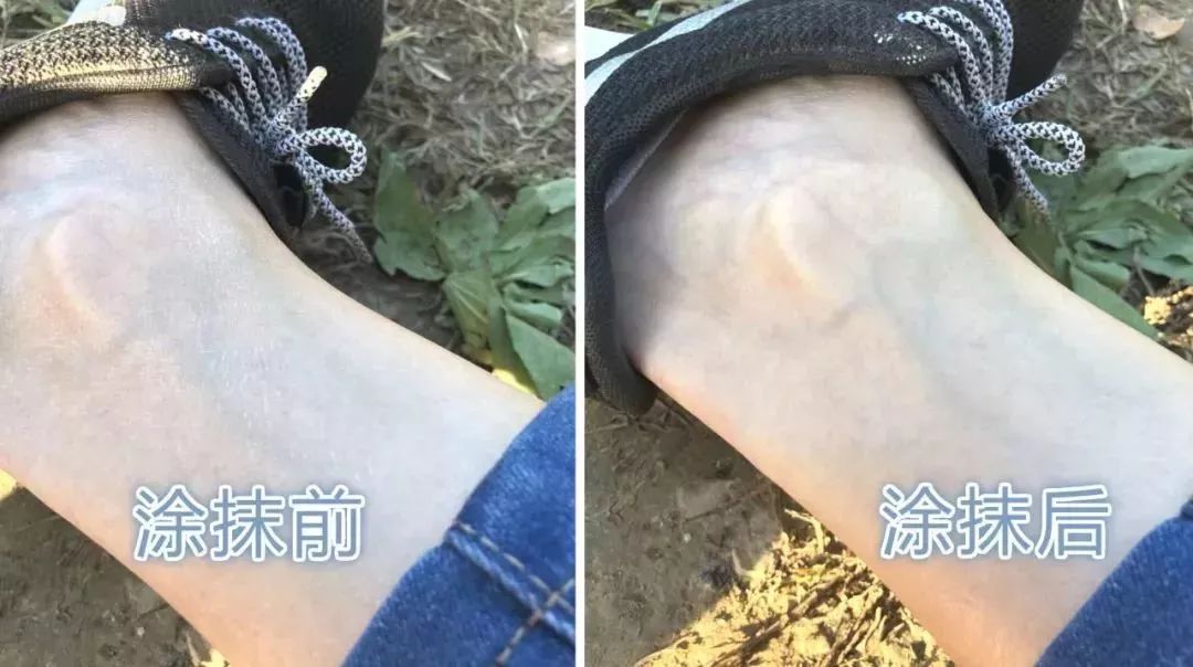 保湿、消炎、止痒、晒后修复,一管芦荟胶全搞定,宝宝也能用